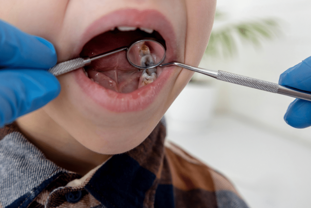 Fluoride Treatments in Holly Springs and Wendell